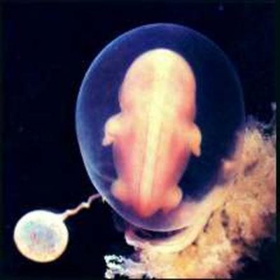 В Австралии начали клонировать человеческие эмбрионы